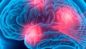 como-trabaja-la-EMT-en-tu-cerebro-2